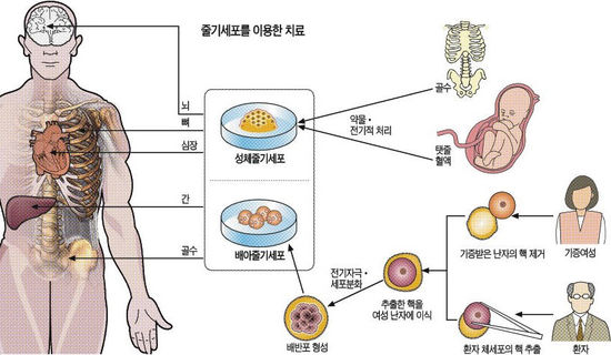 뇌질환ㆍ당뇨 치료에 한걸음 더 다가간 