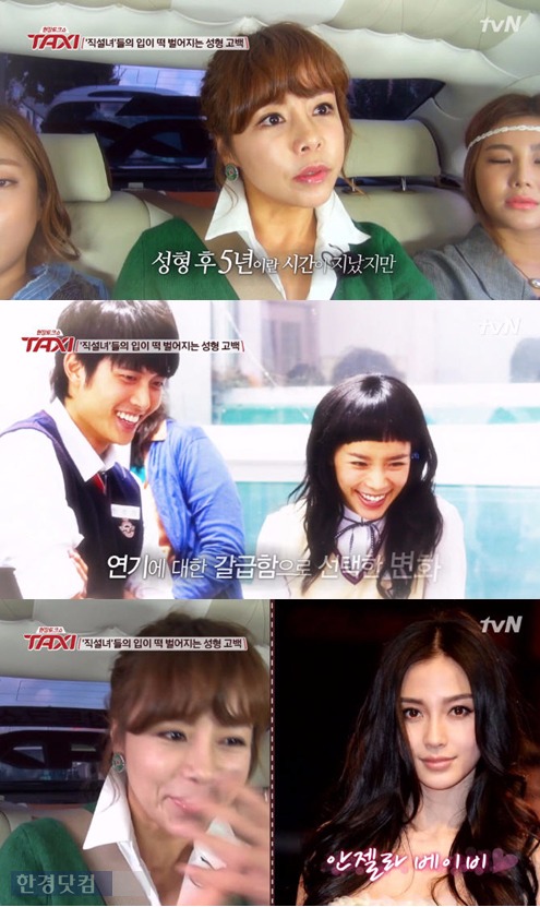 신이 성형수술 /tvN '택시'