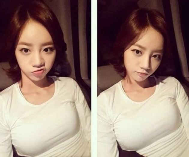 혜리 뇌수막염 혜리 뇌수막염 / 사진 = 혜리 SNS