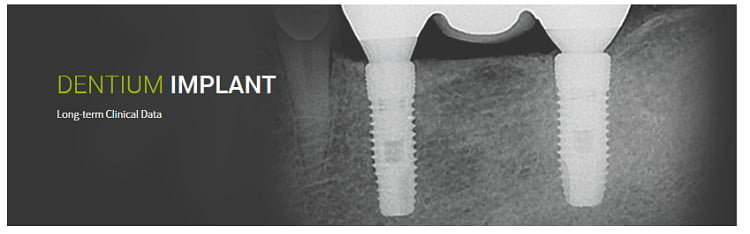 덴티움 임플란트