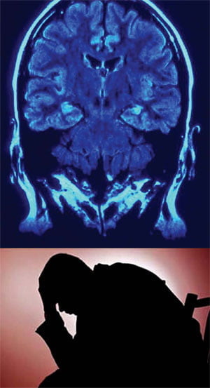 [Science] 정신질환은 뇌의 어느 부분이 고장나 발생하는 걸까?