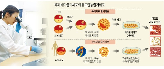 美, 인간 배아줄기세포 복제 첫 성공…치매 등 난치병 '맞춤형 치료'에 청신호