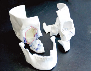3차원(3D) 프린터를 활용해 만든 두개골 모형.