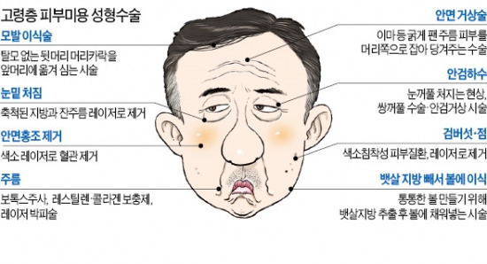 [100세, 기꺼이 수술하는 시대] 주름·처진 눈매 교정…'회춘성형' 붐