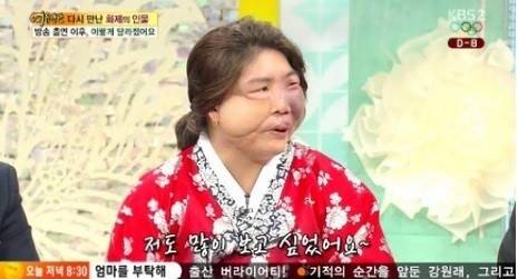 김희아, 안면장애 수술 직전 딸 생각에 그만…'깜짝 고백'