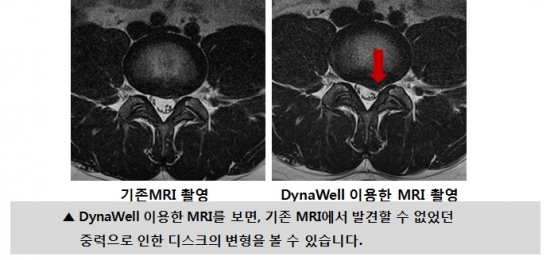 다이나웰 비교 사진