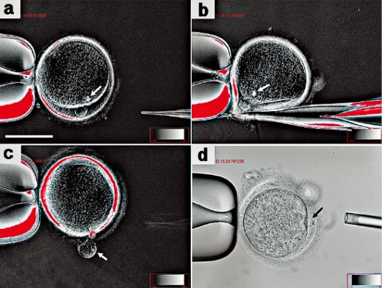 < 체세포 복제 과정 > (a)기증받은 난자(화살표는 제거해야 할 유전물질)→(b)유전물질이 있는 부분을 절개→(c)세포질을 밀어 유전물질 제거→(d)성인 남성의 체세포(화살표)를 난자에 밀어 넣고 융합 유도. 차병원 제공
