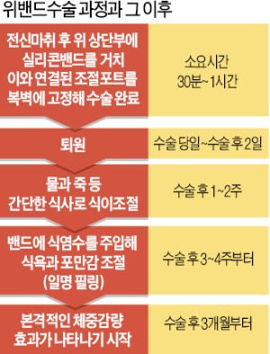 [경찰팀 리포트] 30분 수술에 800만원…미성년자에게도 '위밴드' 권하는 의사들