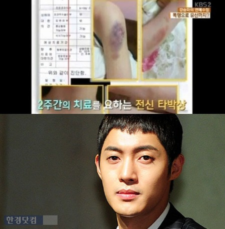 김현중 전 여친 / 김현중 전 여친 = KBS 방송 캡처