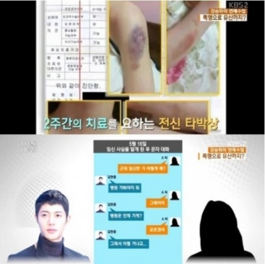 김현중 전 여친 / 김현중 전 여친 폭행 사진=KBS2 방송 캡처