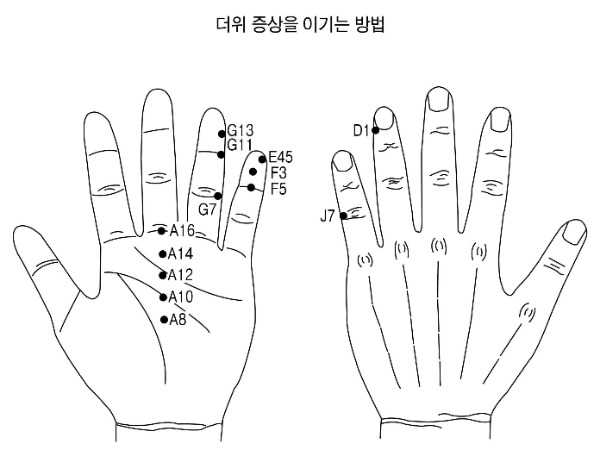 수지침으로 여름철 냉방감기, 더위 증상 이기는 법