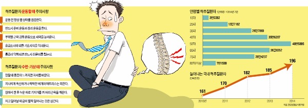 척추 환자에게 가파른 산타기는 독…"걷는 게 최고 운동"