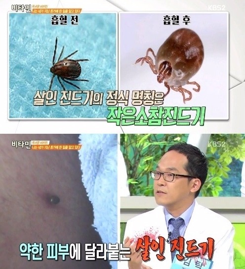 식인 박테리아 살인 진드기 / 사진=KBS 2TV '비타민' 방송화면 캡처