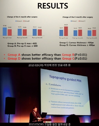 수연세안과, ESCRS(유럽굴절학회) 원추각막 주제 발표…국내 치료기술의 국제적 명성 높여