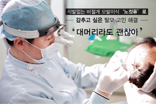 '대머리라도 괜찮아', 삭발없는 비절개 모발이식 '노컷퓨'로 가발러 고민 해결