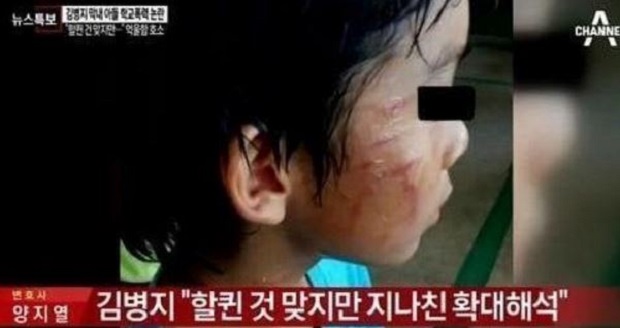 김병지 아들 학교 폭력 논란 김병지 아들 학교 폭력 논란/사진=방송캡쳐