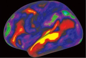 두 배 정밀해진 뇌 지도…국제공동연구진, 대뇌피질 97개 기능 추가 규명
