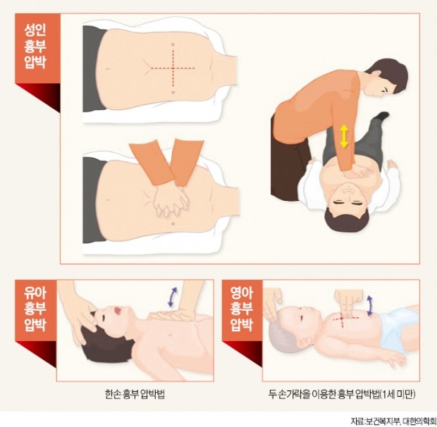 찬바람 부니 가슴이 계속 '뻐근'…심장질환 주의하세요