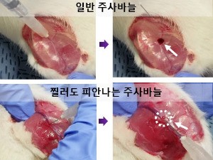 일반동물 모델에 대한 근육주사 후 지혈효과 비교. / KAIST 제공