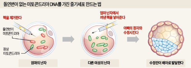 엄마 통해 유전되는 희귀질환 치료길 열렸다