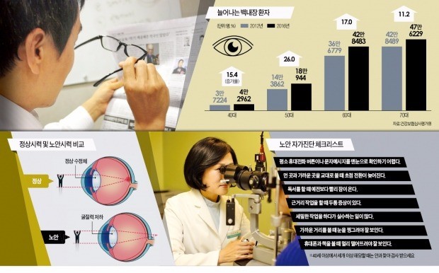 노안으로 흐릿하던 잔글씨가 또렷이 보인다?…백내장 의심해야