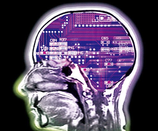 컴퓨터 중앙처리장치(CPU)와 뇌 엑스레이 촬영사진. 국제학술지 사이언스는 머지않아 사람 뇌 기능을 모방한 인공지능이 출현할 수 있다고 예고했다. 사이언스 제공