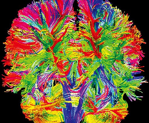 100조개가 넘는 '전체 신경세포들의 연결'을 규명한 뇌커넥톰. 이 지도가 완성되면 인간에게 더욱 가까운 인공지능이 출현할 것이란 전망이 나온다. 휴먼커넥톰프로젝트 제공
