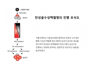 국내 연구팀, 만성 골수성 백혈병의 진행 원리 규명…획기적 치료법 개발 단초 마련