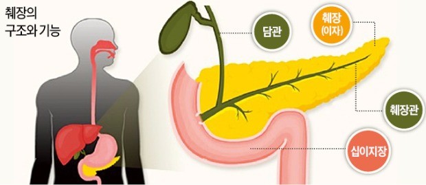 '생존율 낮은' 췌장암…갑작스런 황달·체중 감소·당뇨 악화 땐 의심을