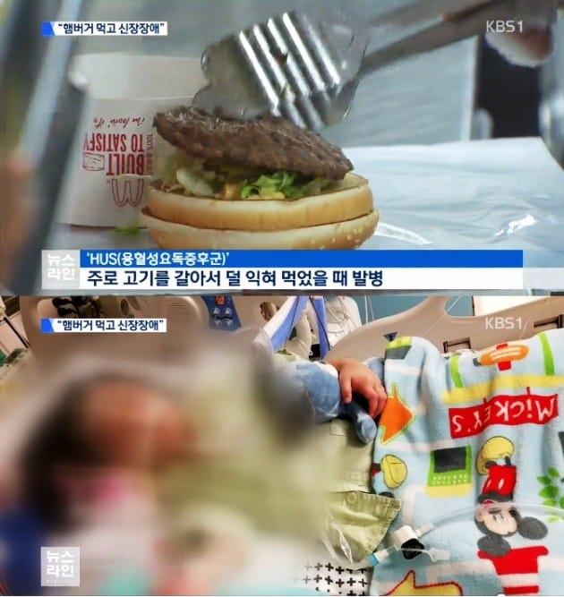 햄버거병 용혈성요독증후군, 맥도날드 고소 / KBS 방송 캡처