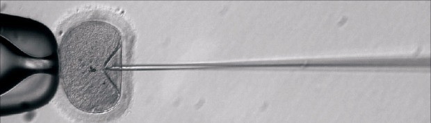 정자와 난자가 수정한 배아에 비후성 심근증 발현 유전자를 제거할 크리스퍼 유전자 가위를 주입하는 모습. 미국 오리건보건과학대 제공