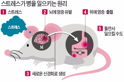 만성 스트레스가 '돌연사' 부른다