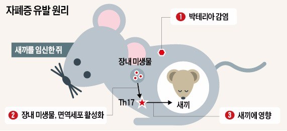 자폐아 출산 원인 밝혀졌다