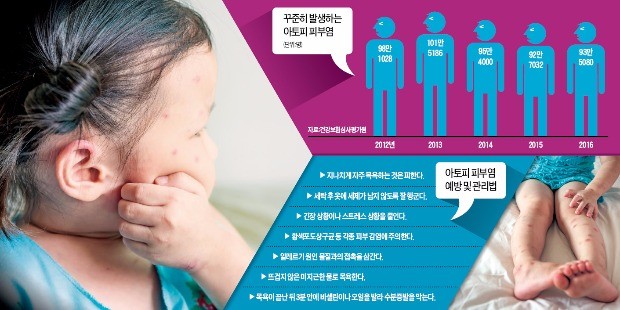 가을바람은 아토피엔 독… 목욕 후 3분내 보습제 발라주세요