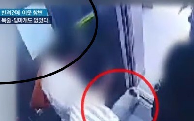 최시원 프렌치불독에 물린 한일관 대표에게서 녹농균 검출…반려견 공포 확산