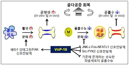 전 세계 2억명 '골골' 골다공증, 완치 가능성 커졌다