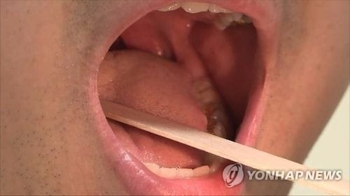 "구강청결제, 구강 내 유익균도 죽인다"