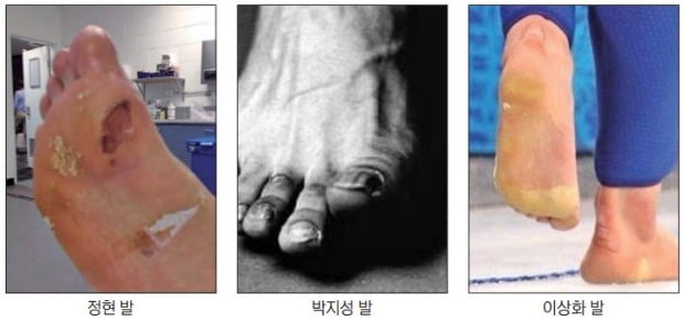 [피플 & 뉴스] 대한민국을 빛낸 '아름다운 발'… 위대함은 노~오력의 열매죠