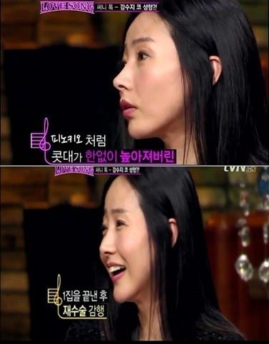 강수지 코 수술 /사진=tvN '러브송' 방송화면 