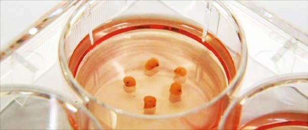 줄기세포를 이용해 만든 뇌 오르가노이드(미니 인공장기) 덩어리가 실험실 샬레(실험용기)에서 배양되고 있다. 싱가포르 게놈연구소 제공 