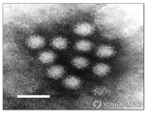 평창서 초등생 집단 구토·복통 증세…18명 노로바이러스 검출