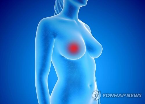 "유방암 위험 변이유전자, 남성에게도 위험"