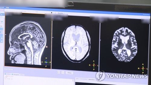 '최대 80만원' 전액부담 뇌·혈관 MRI 검사비 9월부터 내린다