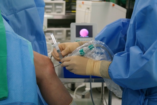 환자 피부를 부분 마취한 후 미니 내시경을 통해 관절안을 확인하고 인보사를 주사하는 사진. 청담우리들병원 제공