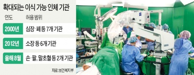 심장·간·폐 이어… 손·팔 이식도 합법화