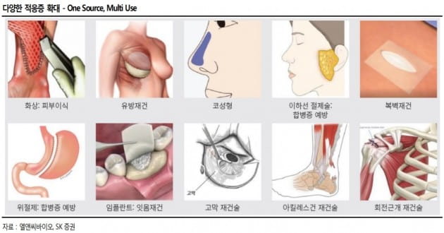 "엘앤씨바이오, 인체조직 기반 이식재 가치 상승 중"-SK