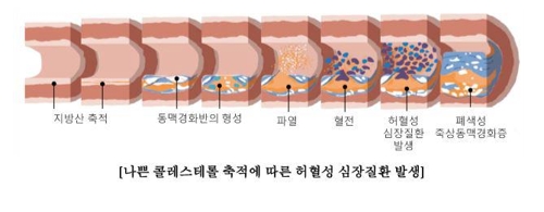 심장 위협하는 가을철 일교차…40대부터 주의해야