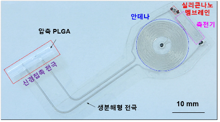 신경치료 후 몸에서 자연 분해되는 '전자약' 나왔다