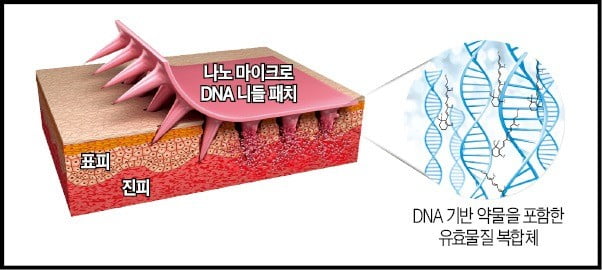 바늘 품은 반창고 '니들 패치' 등장…동네 병원서 바늘 주사기 사라진다