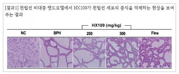 바이로메드, 천연물 복합제재 'HX109' 전립선비대증 치료효과 확인